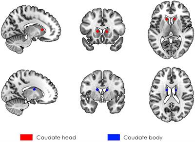 The Interaction Between Caudate Nucleus and Regions Within the Theory of Mind Network as a Neural Basis for Social Intelligence